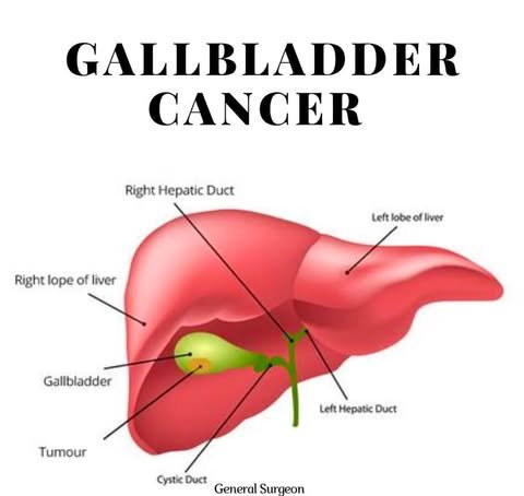 Gallbladder