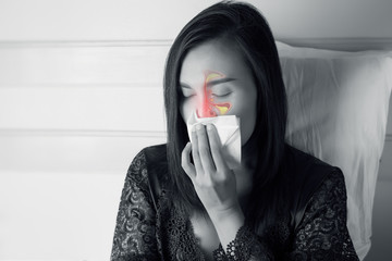 Sinus Headache