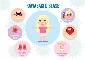 Kawasaki Disease Treatment