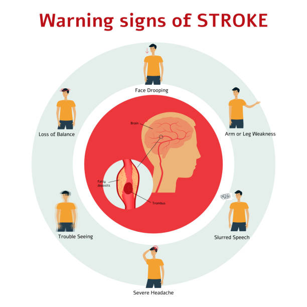 Signs of a Heart Attack