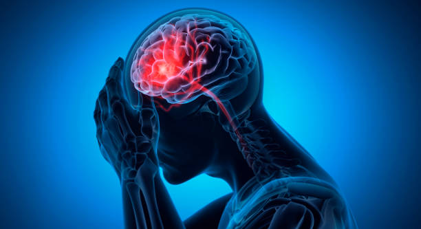 COVID Headache