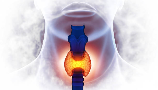 Stage 4 Esophageal Cancer
