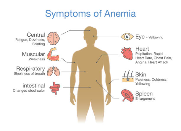 anemia-symptoms