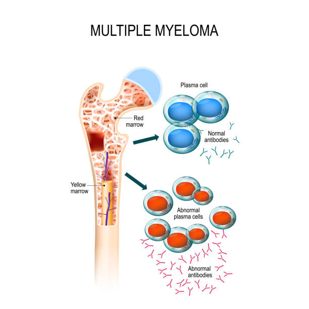 Myeloproliferative neoplasms