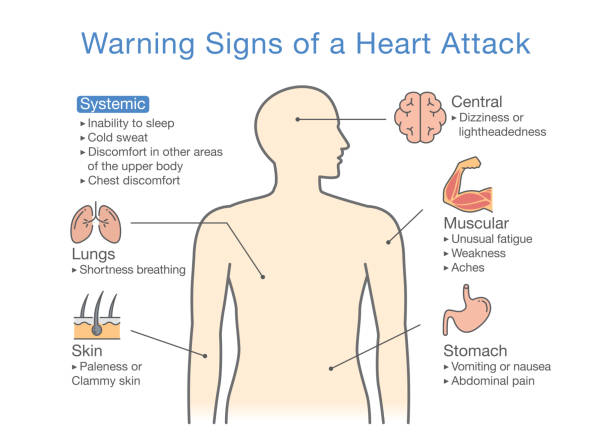 Signs of a Heart Attack