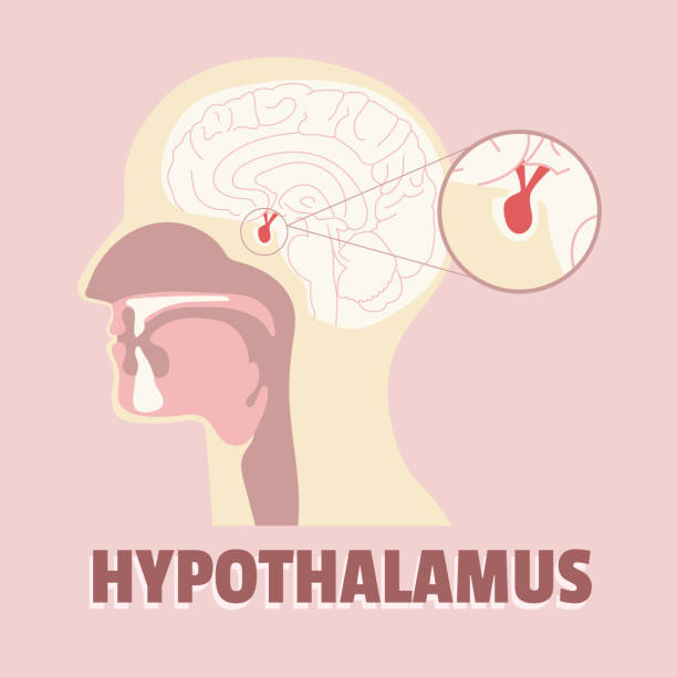 Hydrocephalus in Adults