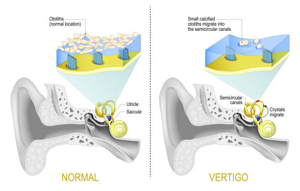 VA Tinnitus