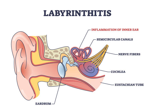VA Tinnitus